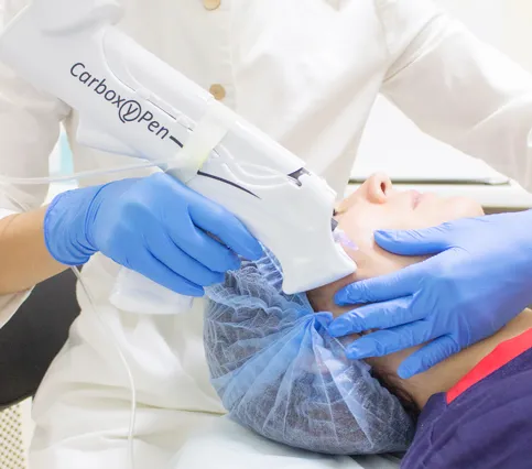 Карбокситерапия для лица