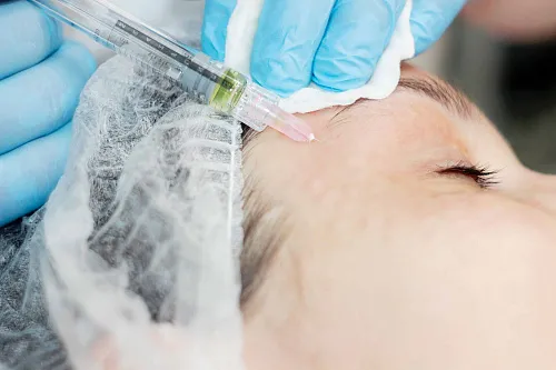 Мезотерапия лица и шеи