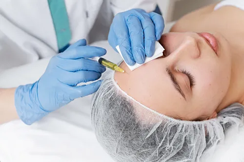 Плазмотерапия Cortexil PRP