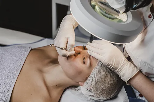 Механическая чистка лица