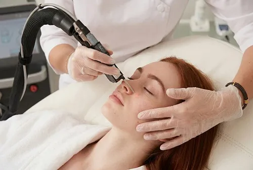 Удаление сосудов