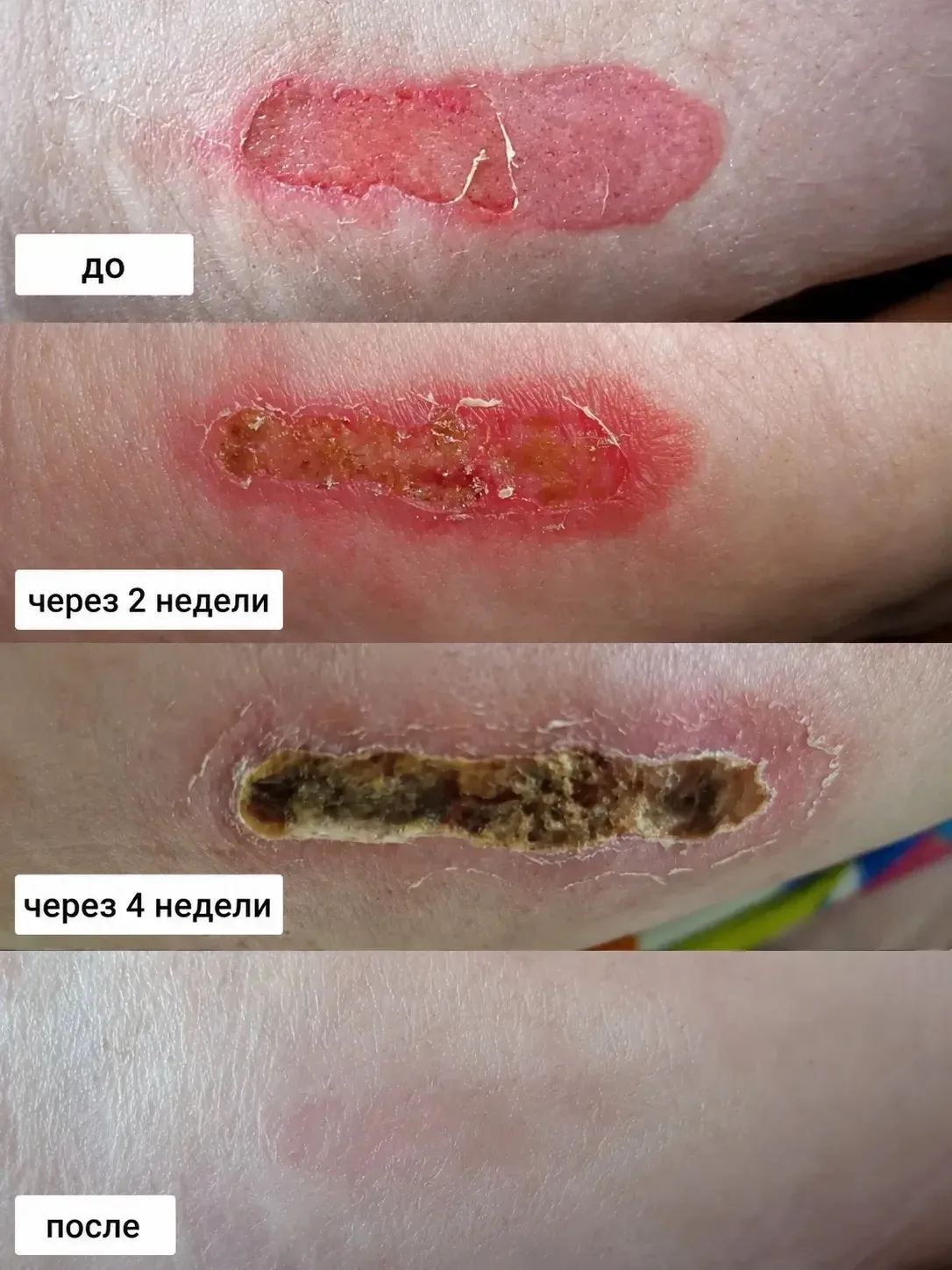 Новости