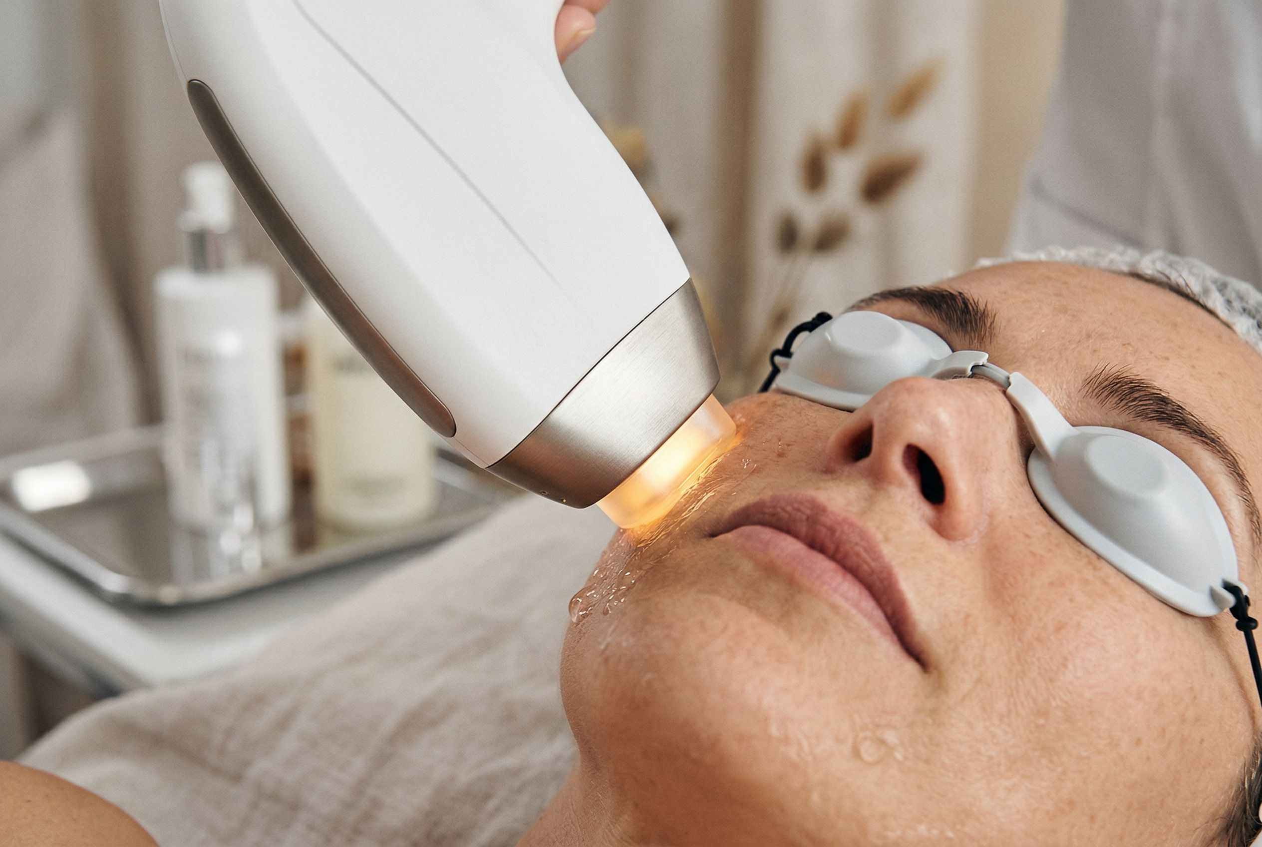 Фотоомоложение по технологии IPL