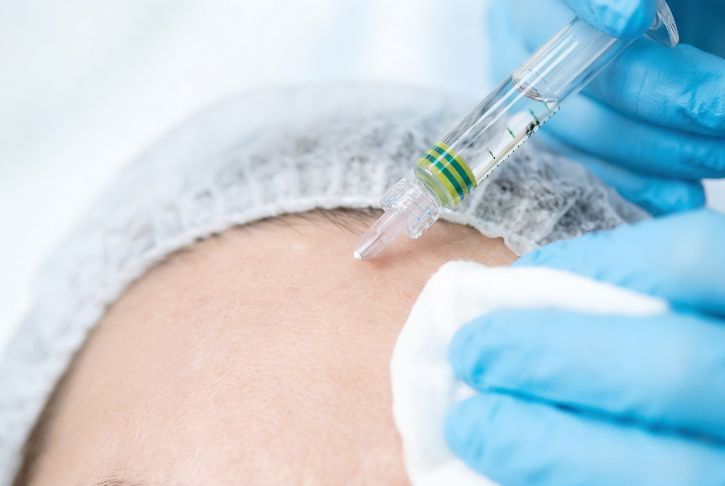 Мезотерапия лица и шеи