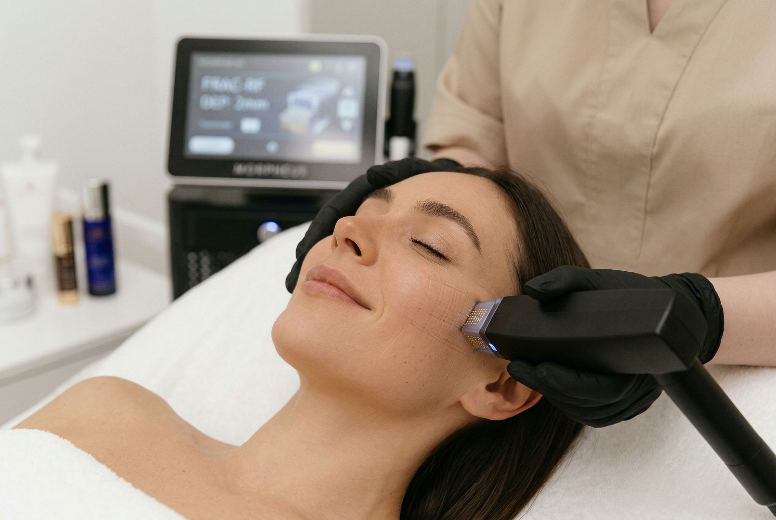 Игольчатый RF-лифтинг Morpheus8