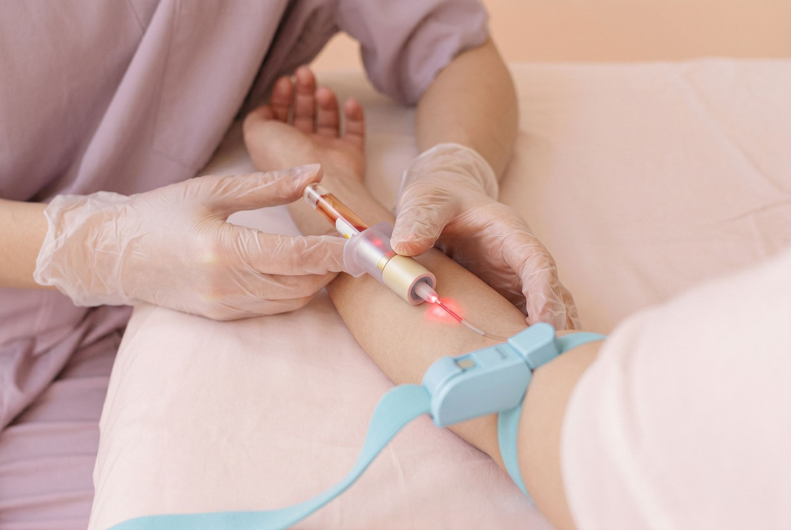 Внутривенное лазерное облучение крови (ВЛОК)