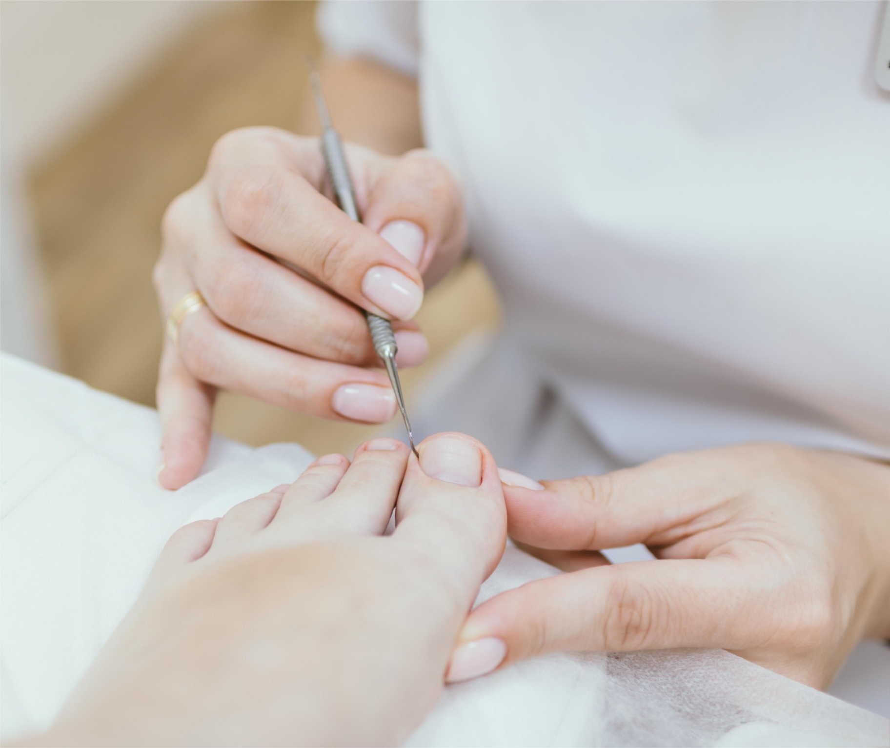 Коррекция вросшего ногтя