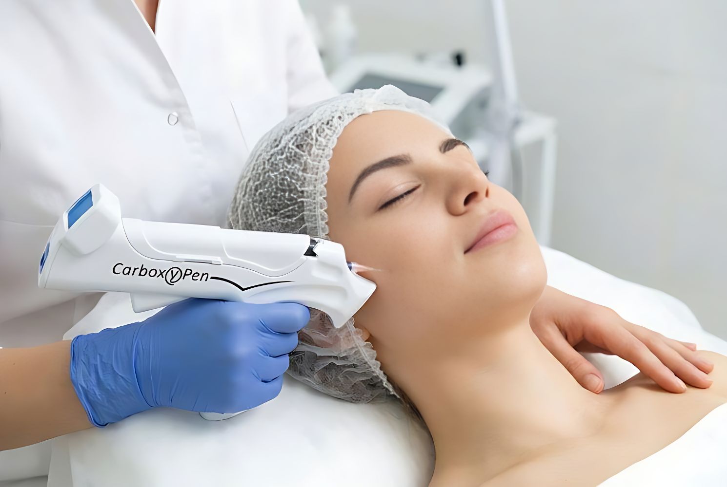 Карбокситерапия для лица