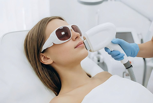 Фотоомоложение по технологии IPL