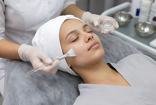 Химический пилинг лица