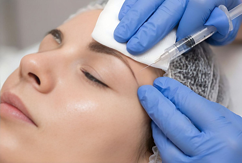 Мезотерапия лица и шеи