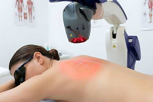 MLS лазеротерапия