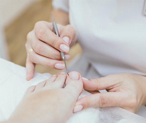 Коррекция вросшего ногтя