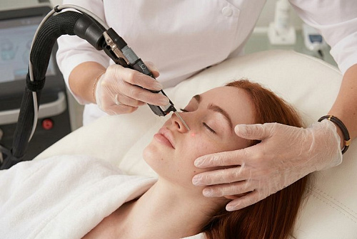 Удаление сосудов