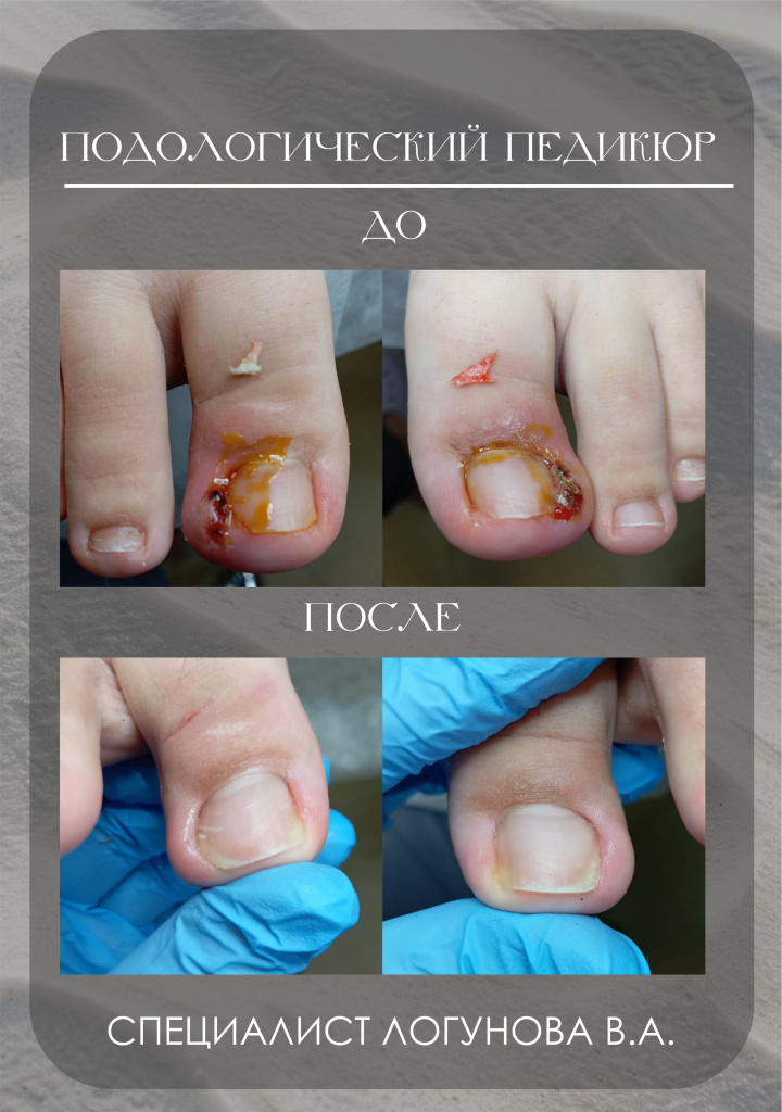 до после Логунова.jpg до после Логунова.jpg